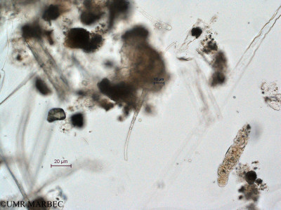 phyto/Scattered_Islands/all/COMMA April 2011/Cylindrotheca gracilis (ancien C. sp2 cf gracilis)(copy)_thumb.jpg